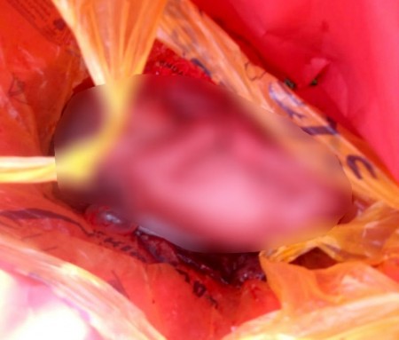 Mulher suspeita de abandonar recém-nascido em sacola plástica é identificada no interior de SP