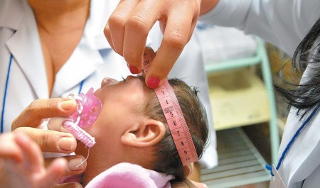 Governo estuda BPC permanente para pessoas com microcefalia