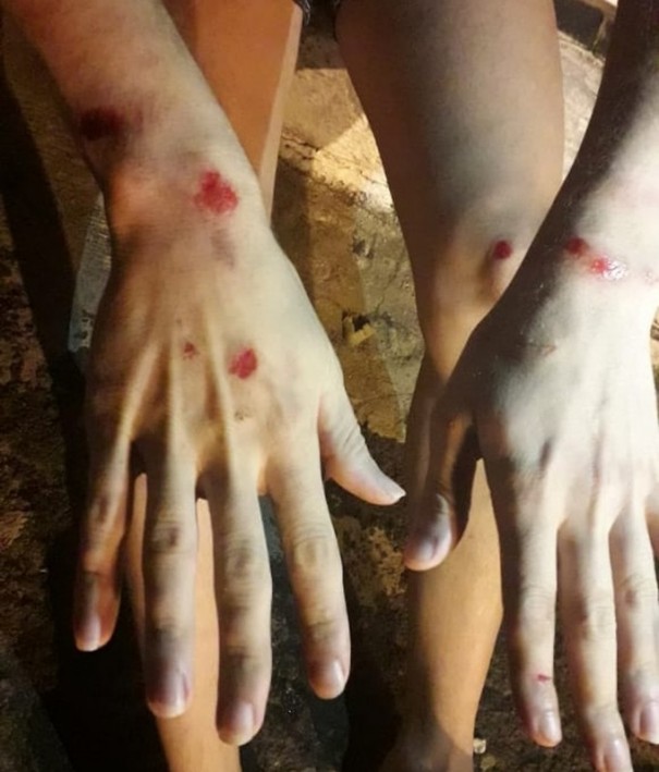 Jovem � agredido em Tup� e alega homofobia: 'Disseram que 'viado' tinha que morrer'