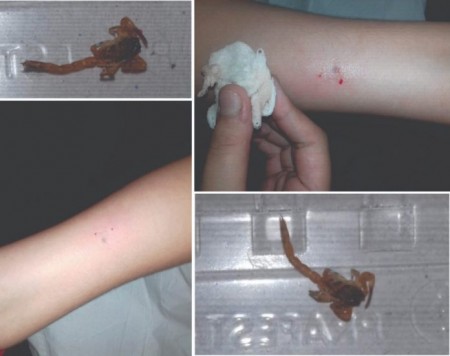 60 casos de picadas de escorpiões são registrados em Adamantina neste ano
