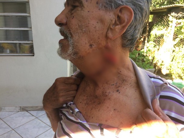 Ex-vereador � agredido com golpe de faca, em Sagres 