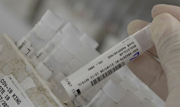 Anvisa autoriza uso emergencial e temporrio de vacina contra covid-19