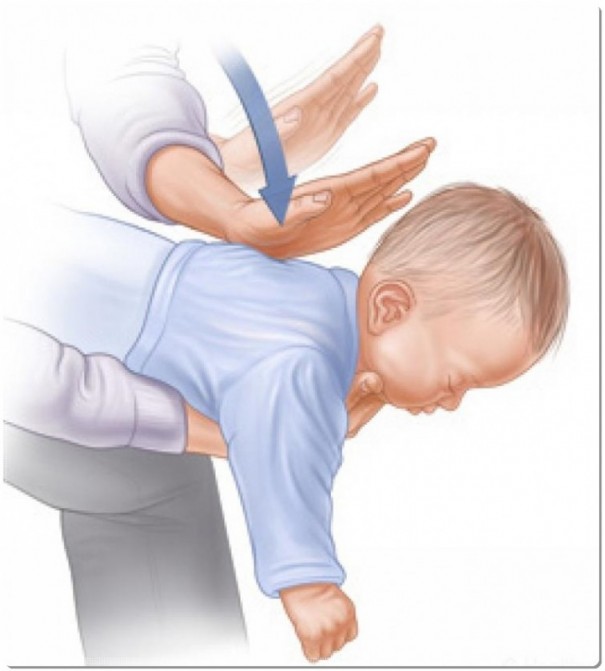 Beb de 16 dias  salvo por policial aps engasgar com leite materno em Tup