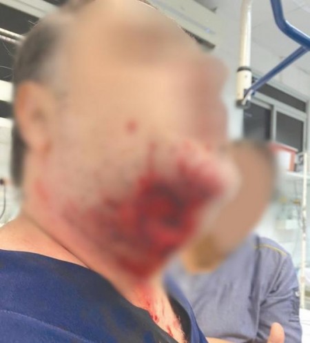 Médicos são agredidos durante plantão em Araçatuba