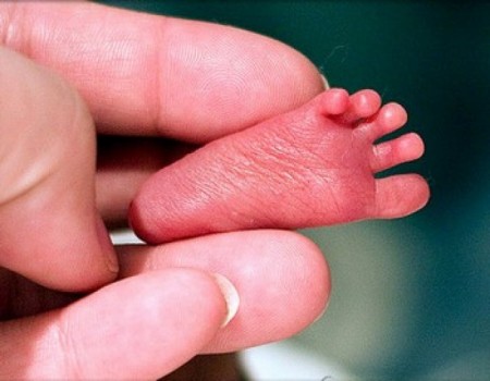 Feto humano é localizado na rede de esgoto em Monte Castelo