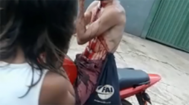 Motociclista sofre corte profundo no pescoo provocado por cerol, perde sangue e vai para UTI