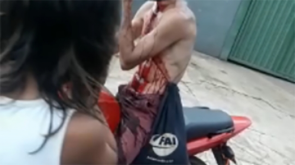 Motociclista sofre corte profundo no pesco�o provocado por cerol, perde sangue e vai para UTI