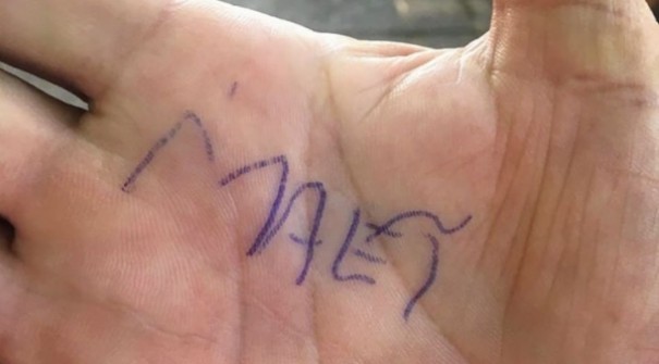 Adolescente vtima de atropelamento acorda do coma e escreve 'me' na mo do pai