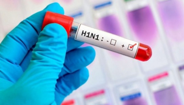 Vigilncia Epidemiolgica registra seis casos confirmados de H1N1 em Assis