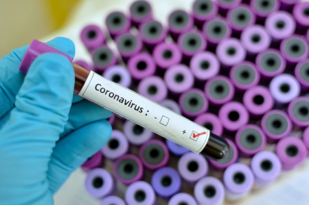 SP confirma quatro mortes pelo coronavírus no estado
