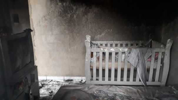 Beb� de 7 meses tem 70% do corpo queimado durante inc�ndio em Ara�atuba