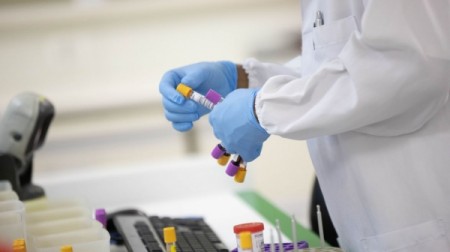 Tupã tem confirmado primeiro caso de reinfecção por Covid-19