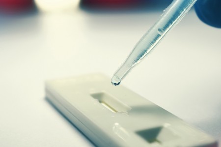 Campanha 'Fique Sabendo 2020' não registrou casos positivos de HIV e Sífilis em OC