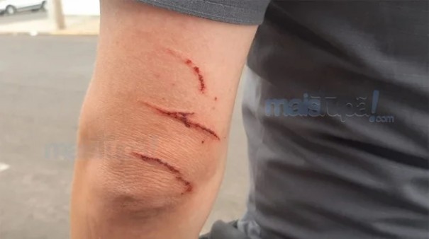 Pol�cia Militar impede estrangulamento de mulher em Tup�