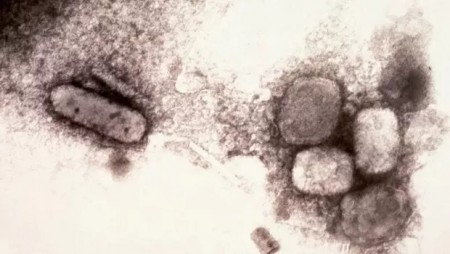 Varíola dos macacos: qual a diferença da doença para a varíola humana, erradicada há 40 anos