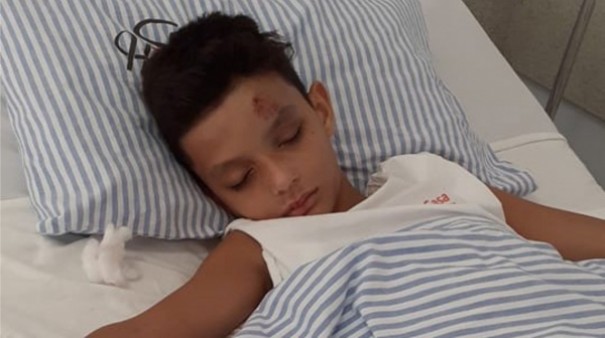 No hospital, menino de 10 anos se recupera de fraturas aps ser atropelado na sada da escola