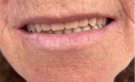 Secretaria de Saúde de Salmourão retoma o programa Brasil Sorridente