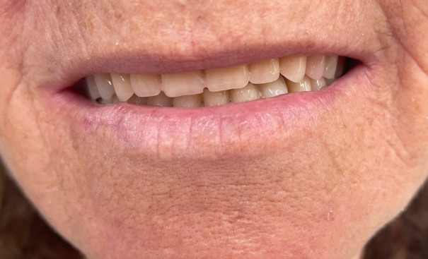 Secretaria de Sa�de de Salmour�o retoma o programa Brasil Sorridente