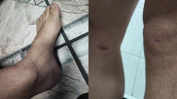 Pai que acompanhava filha no caminho para escola � espancado ao ser confundido com estuprador, diz pol�cia