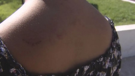 Justiça determina que homem acusado de agredir companheira a marretadas seja internado em hospital psiquiátrico