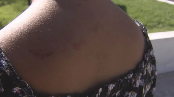 Justi�a determina que homem acusado de agredir companheira a marretadas seja internado em hospital psiqui�trico