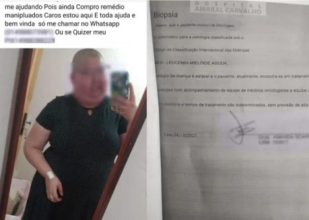 Polícia investiga mulher que fingiu ter câncer para arrecadar dinheiro e insumos de prefeitura no interior de SP