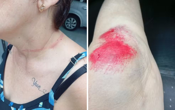 Motociclista tem pescoço atingido por cabos soltos em avenida em Birigui