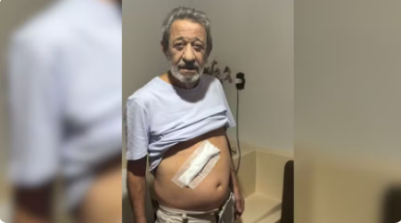 'Um dos piores momentos da vida', diz idoso que teve vesÃ­cula retirada em cirurgia de hemorroida