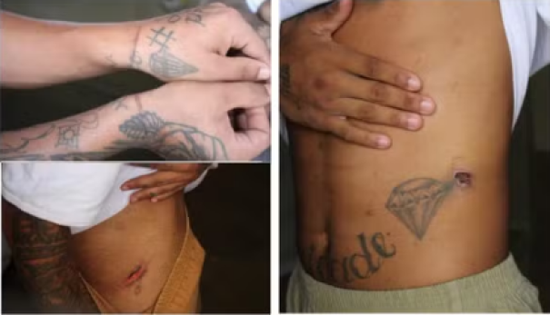 Defensoria pede à Justiça apuração de denúncias de maus-tratos a 51 presos da Penitenciária de Martinópolis, no interior de SP