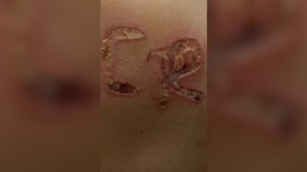 Marido é preso após marcar iniciais do nome dele no corpo da esposa no interior de SP