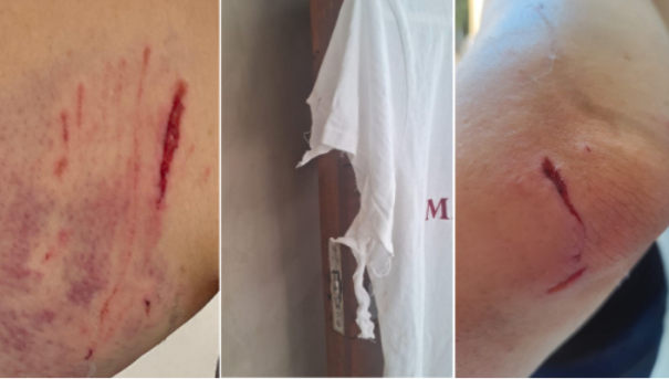 Enfermeira é atacada por três cães soltos durante caminhada em parque de Adamantina