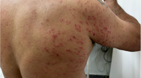 Homem sofre ataque de abelhas em Osvaldo Cruz e vai parar na Santa Casa