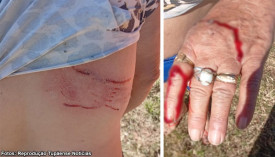 Cachorro solto ataca mulher e gera preocupaÃ§Ã£o entre moradores em TupÃ£