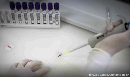 Paciente em SP com suspeita de ebola testa positivo para meningite