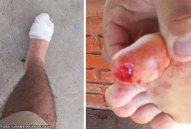 Morador de Bastos sofre ferimento apÃ³s ataque de piranha no balneÃ¡rio de Rancharia