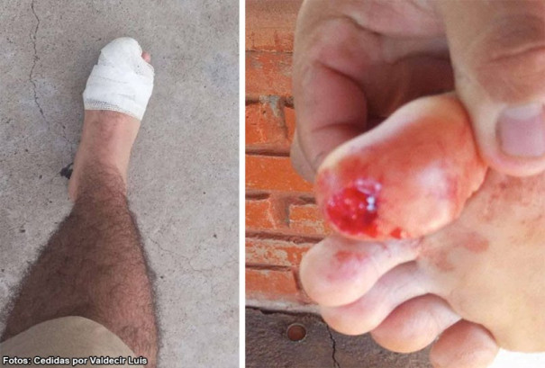 Morador de Bastos sofre ferimento após ataque de piranha no balneário de Rancharia